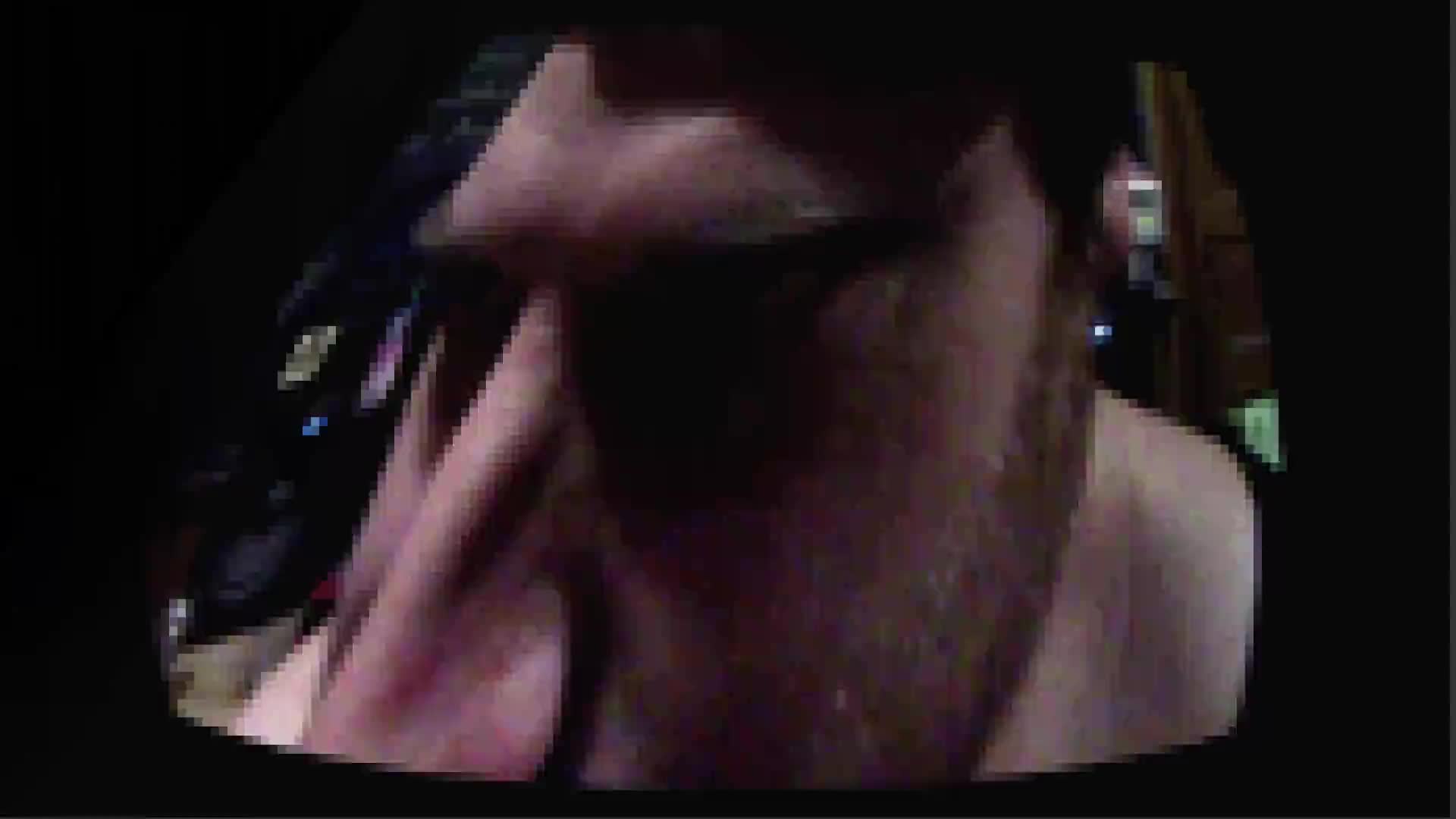 To view this video, become a TotalVOM member.