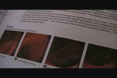 To view this video, become a TotalVOM member.