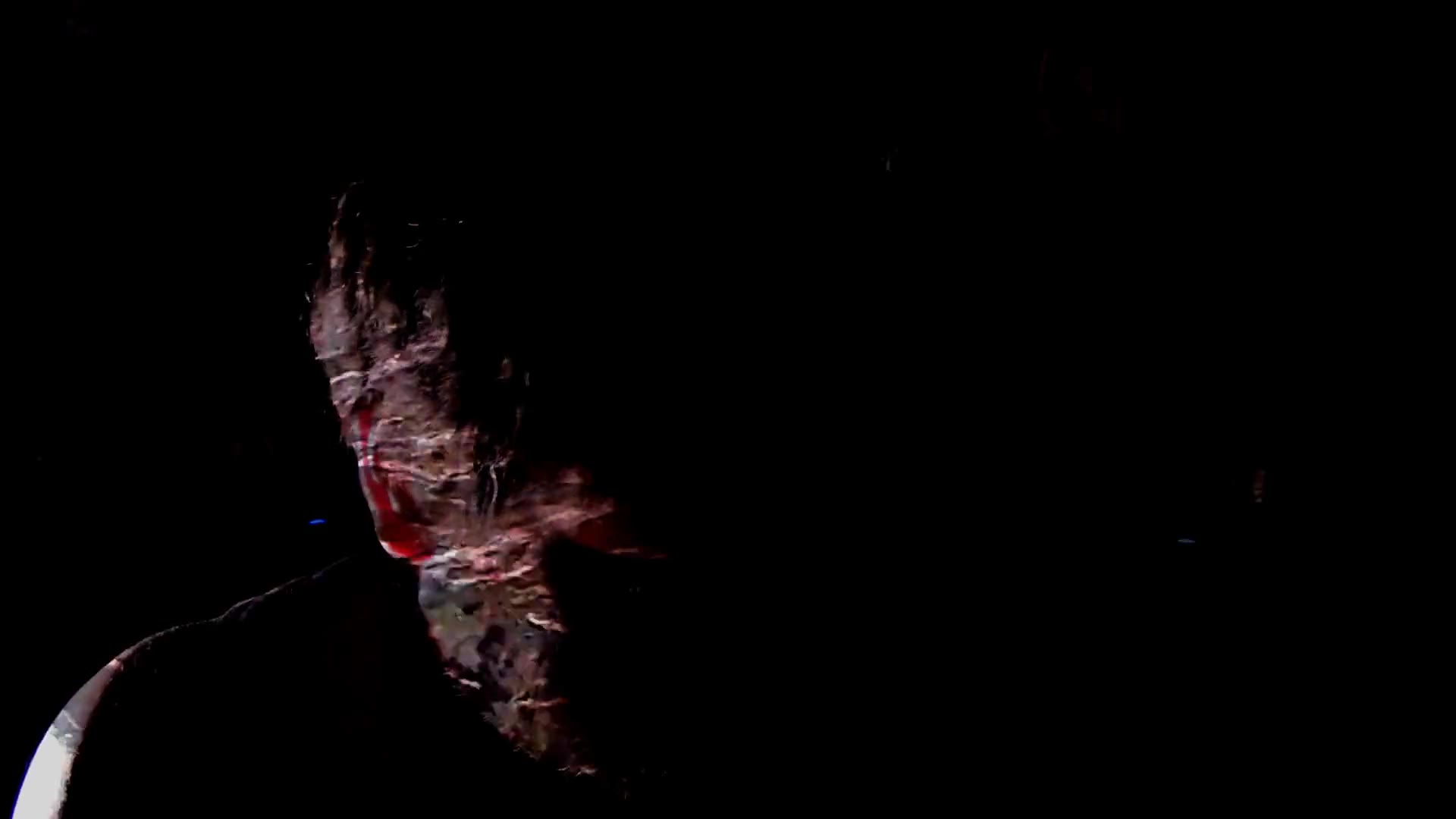 To view this video, become a TotalVOM member.