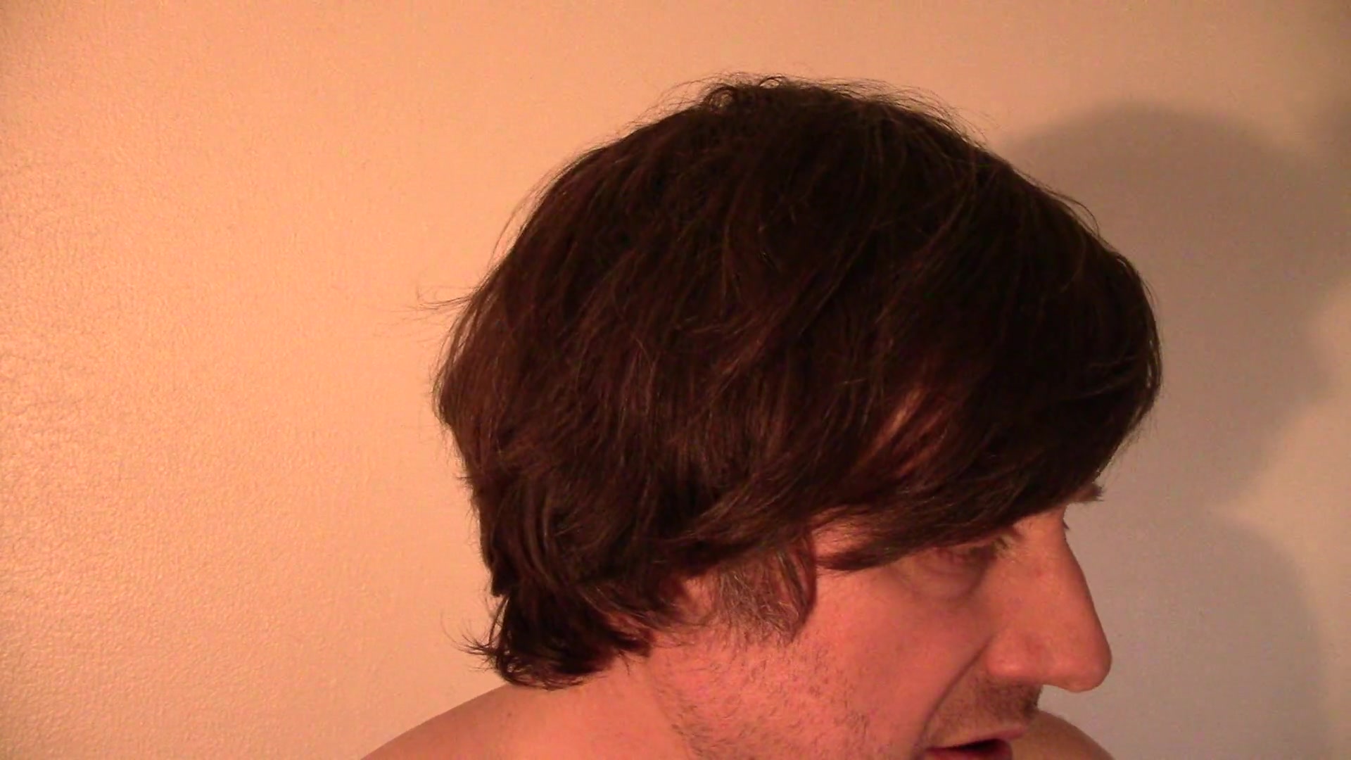 To view this video, become a TotalVOM member.