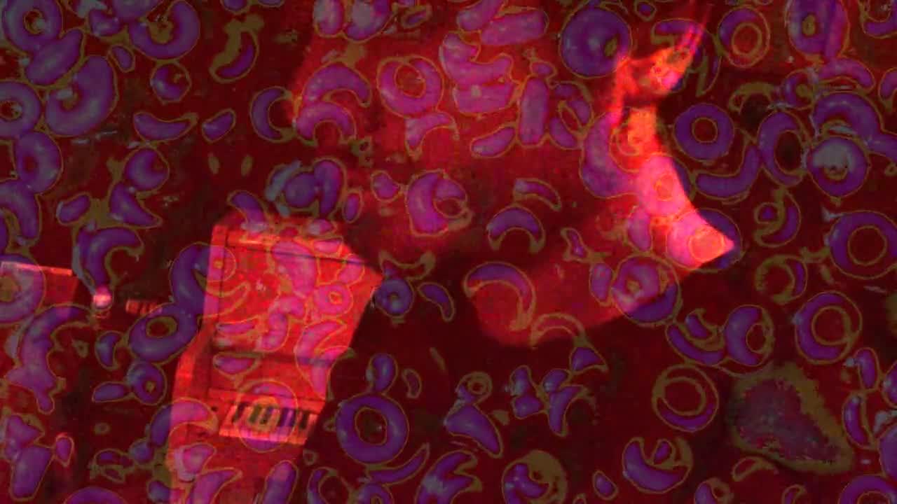 To view this video, become a TotalVOM member.