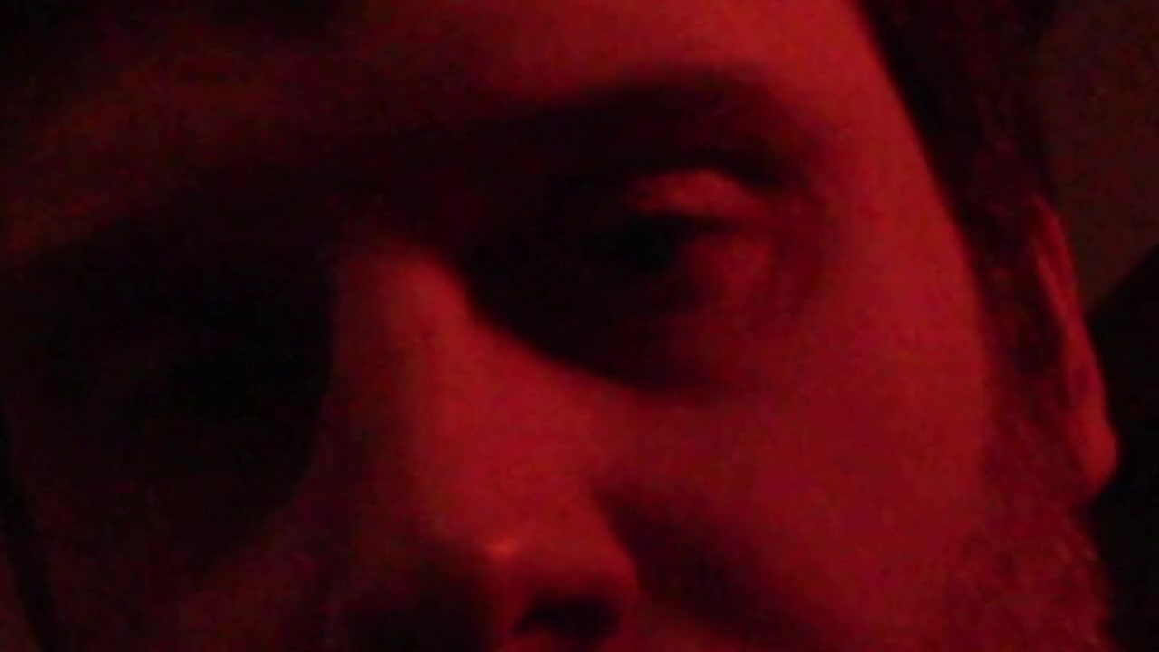 To view this video, become a TotalVOM member.